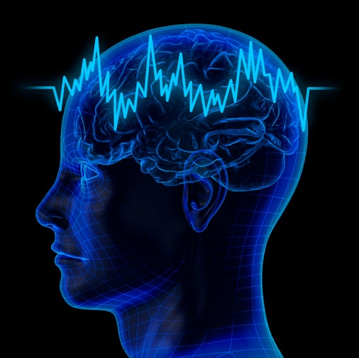 Blog 7 cerebro no duerme